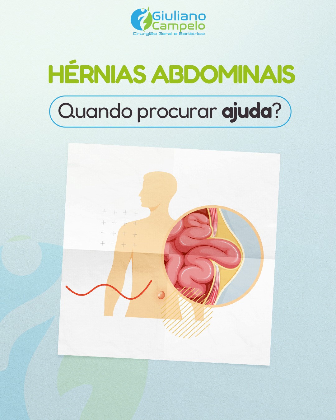 Hérnias Abdominais: Quando procurar ajuda?