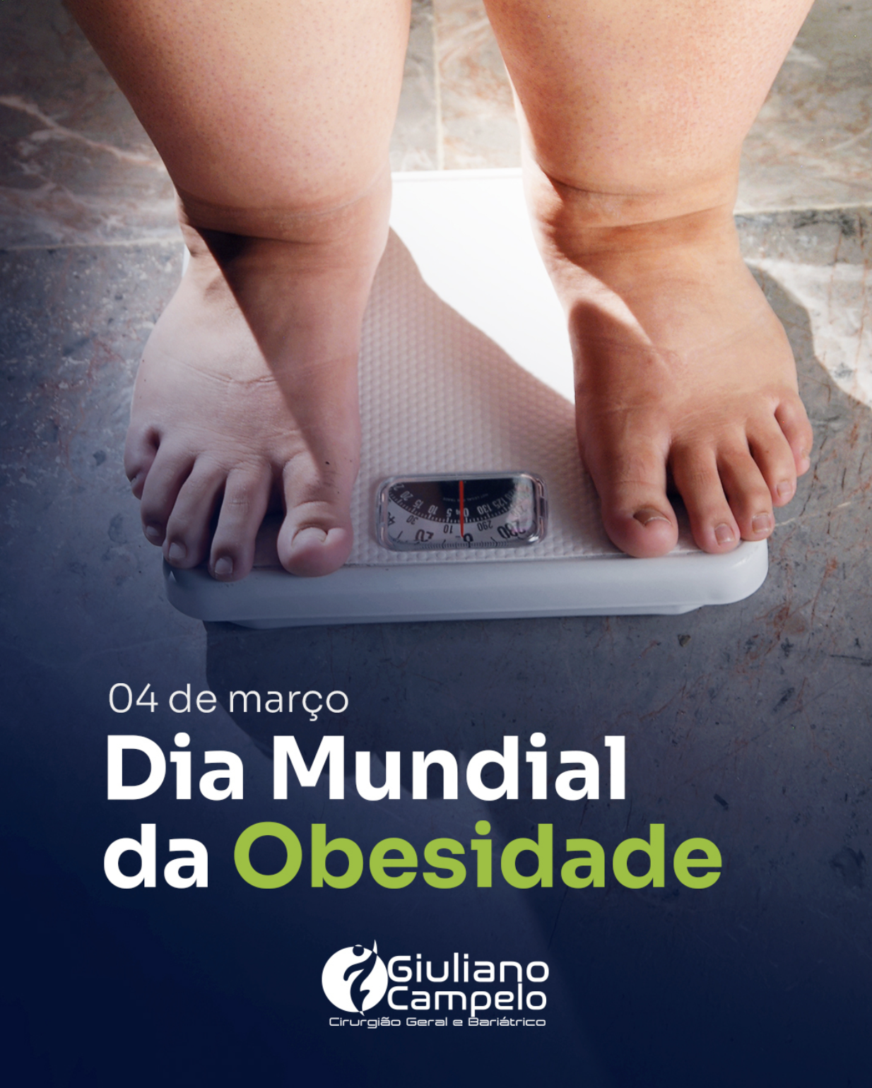 04/03 – Dia Mundial da Obesidade