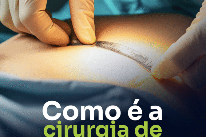 Como é a cirurgia de hérnia hoje em dia?
