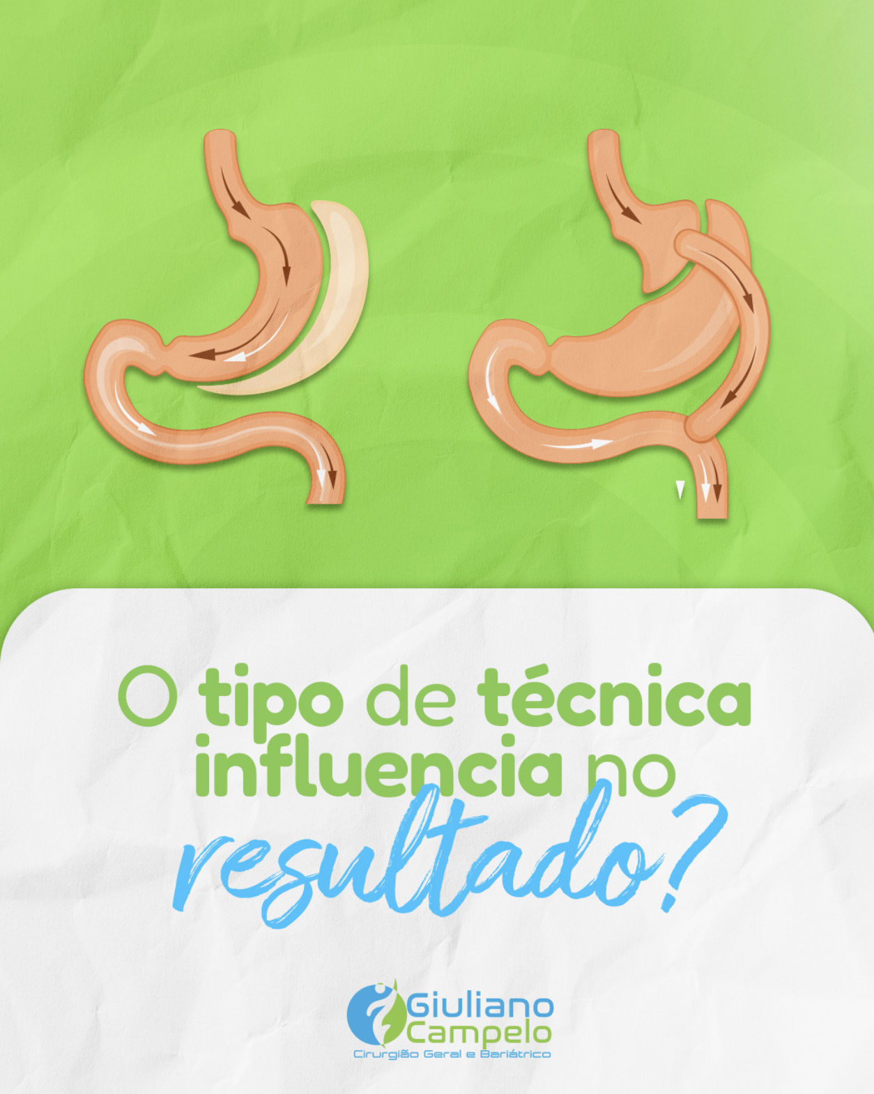 O tipo de técnica influencia no resultado?