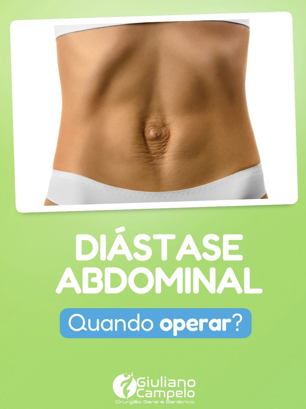 Diástase Abdominal: Quando operar?