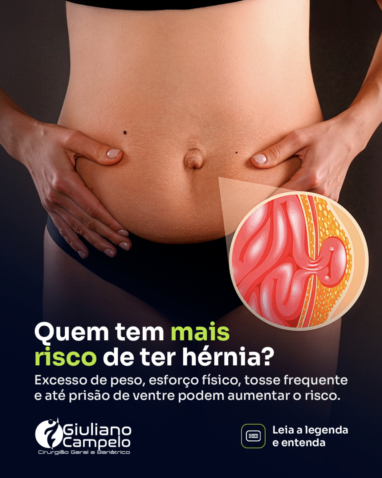 Quem tem mais risco de ter hérnia?
